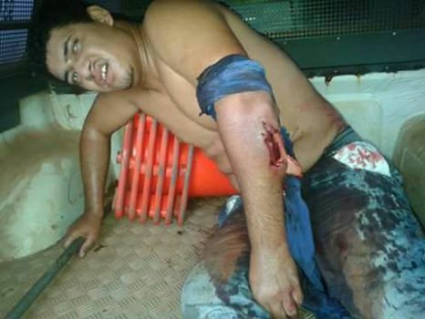 Bandido é baleado após trocar tiros com a polícia em Mirante da Serra